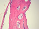 Hyaline cartilege, 100x