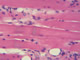 Cardiac muscle, 400x