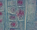 Onion skin, 1000x, late prophase